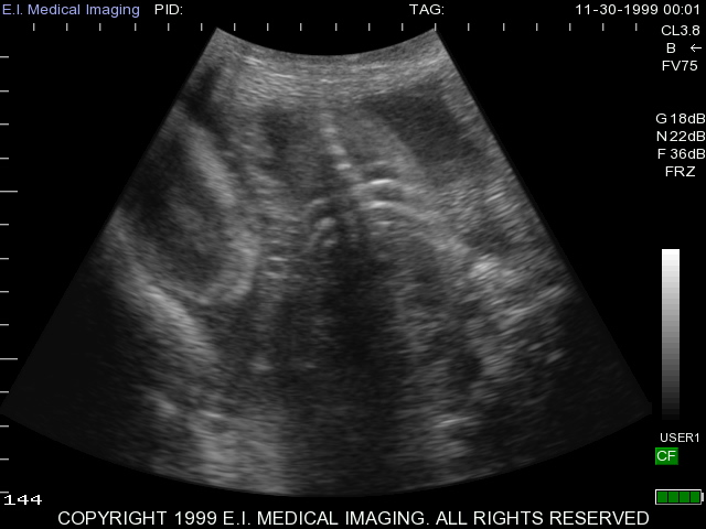mule deer ultrasound