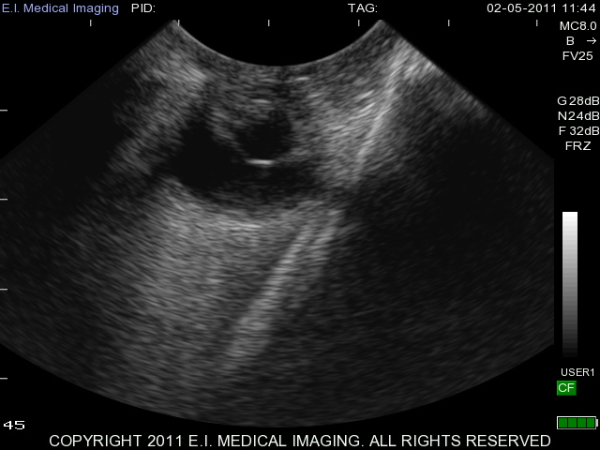 Canine Eye Ultrasound