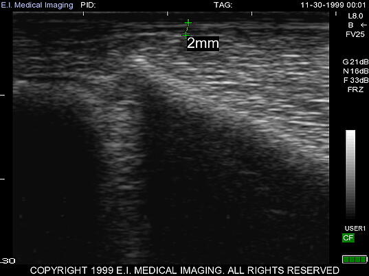 mule deer back fat ultrasound