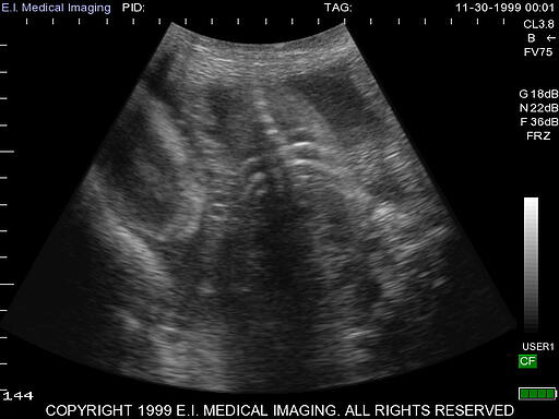 mule deer ultrasound