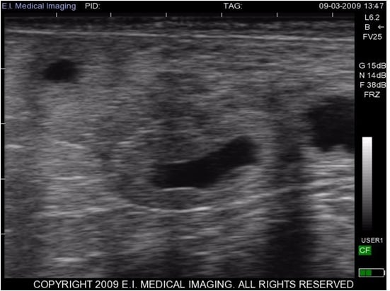 bovine ultrasound 25 day