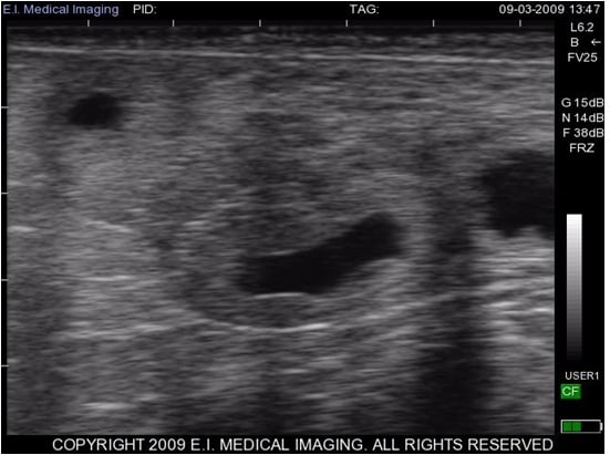 Bovine Fetal Aging Chart