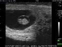 bovine pregnancy ultrasound, bovine ultrasound, cow ultrasound