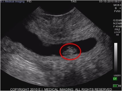 32 day bovine pregnancy ultrasound
