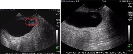 cattle ultrasound 37 day