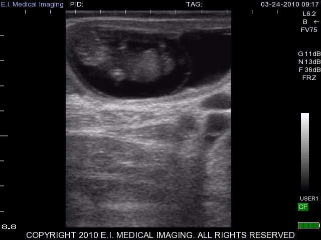 53 day bovine fetus 7.5MHz