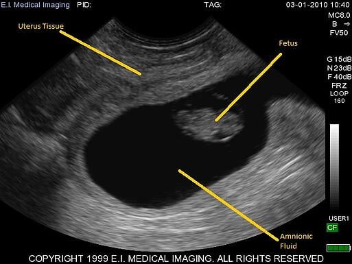 bovine ultrasound, cattle ultrasound