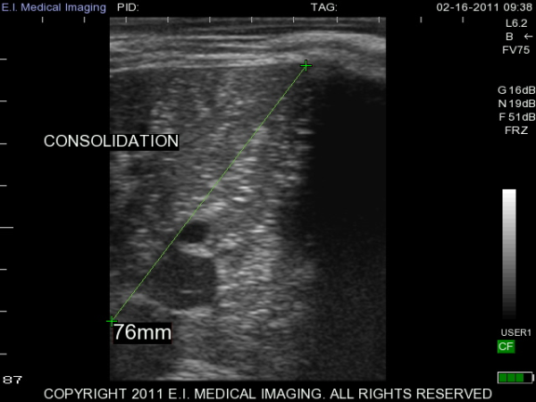 Scanned calf lung'