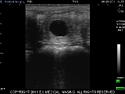 Equine Ultrasound, ultrasound mare