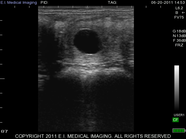 Equine Ultrasound, ultrasound mare