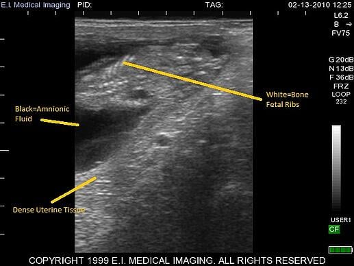 bovine ultrasound, heifer calf fetal sexing