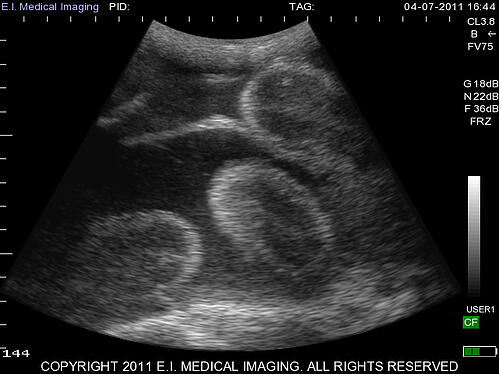 Deer pregnancy ultrasound