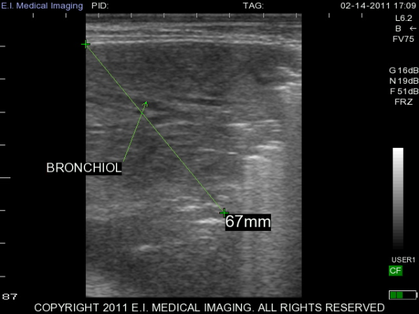 Ultrasound image calf bronchiol