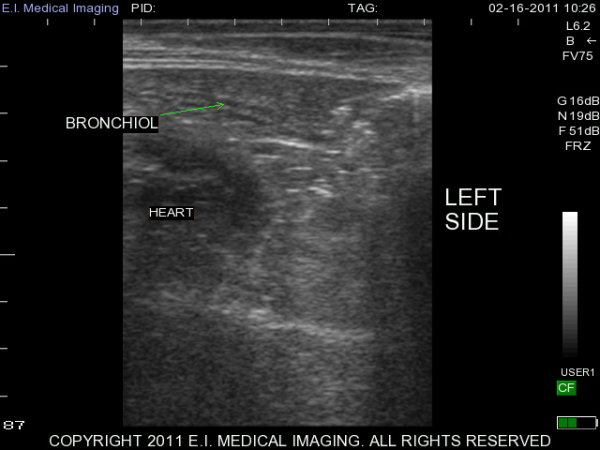 Ultrasound image calf bronchiol 2