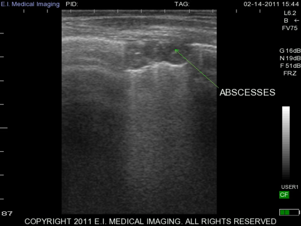 Ultrasound image calf absecesses