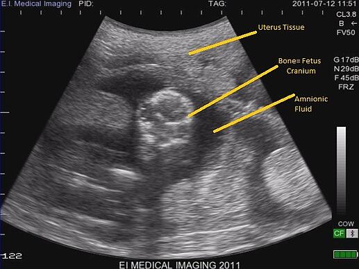 sheep ultrasound