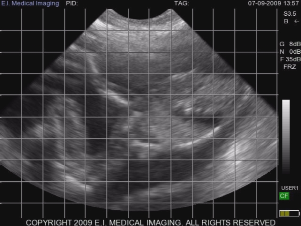 Sheep Cranium   Thorax w heart   Front leg 75 days plus w 3.5MHz Sector probe resized 600