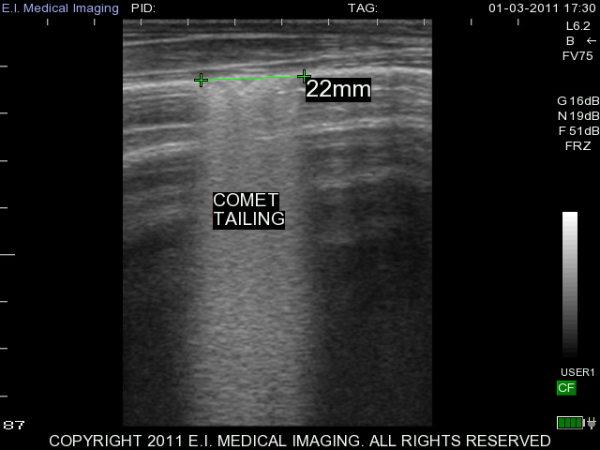 Ultrasound scan of calf lung with comet tailing
