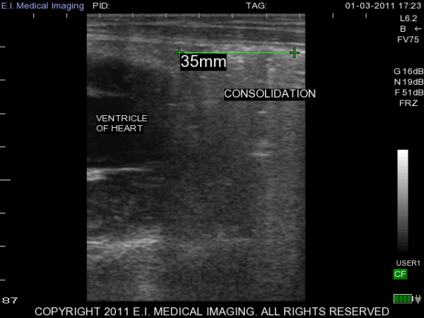 Ultrasound image calf consolidation