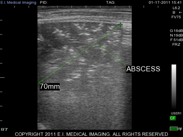 ultrasound image calf lung abscess