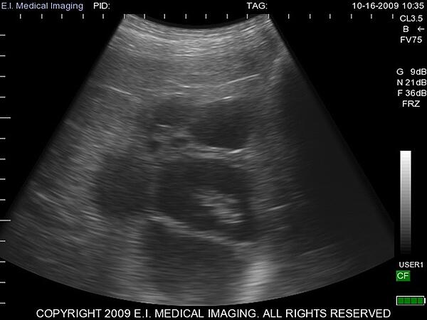 Ultrasound Image EIMI