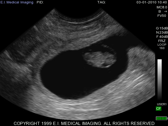 Bovine early micro