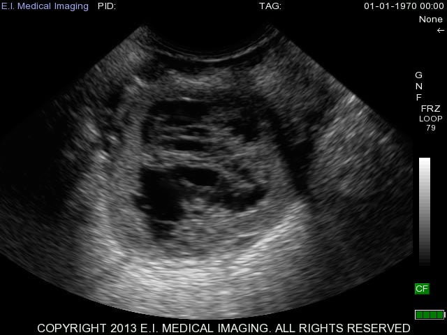 Bovine Ultrasound corpus luteum