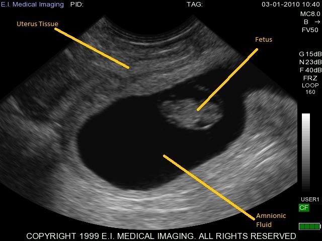 bovine ultrasound pregnancy