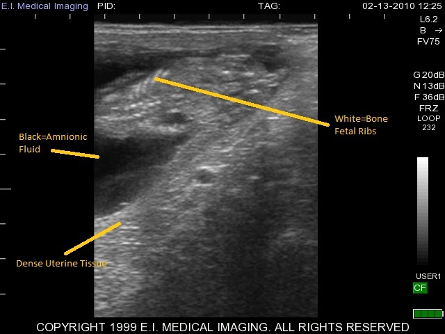 Bovine ultrasound heifer calf