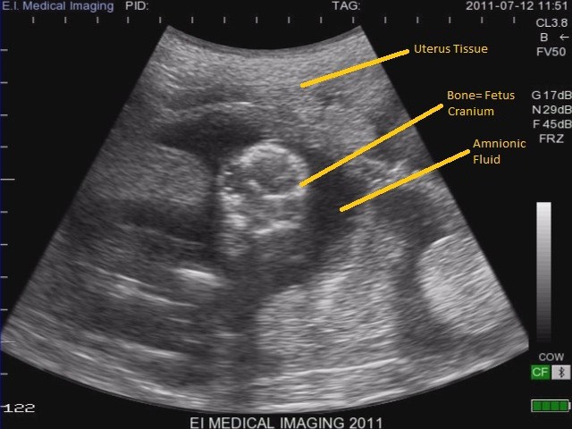 sheep 63 day ultrasound