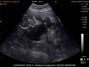 ultrasound image goat fetus (skull)
