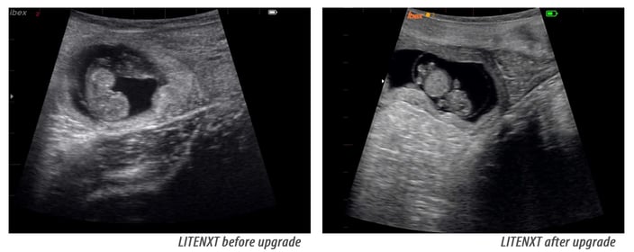 LITENXT-B&A-firmware-upgrade