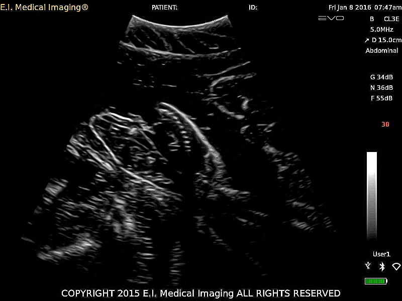 shark pups w teeth in utero.png